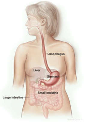 Stomach Cancer