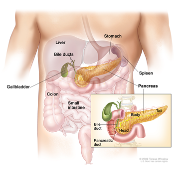 Pancreatic cancer